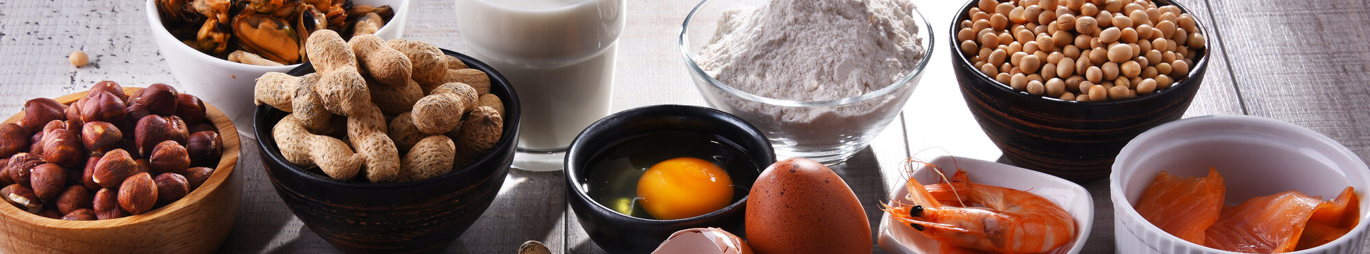 Darstellung von allergenen Lebensmitteln wie Nüsse, Milch, Eier, glutenhaltiges Getreide, Soja, Krebstiere, Fisch und mehr [Foto: ©monticellllo - stock.adobe.com]